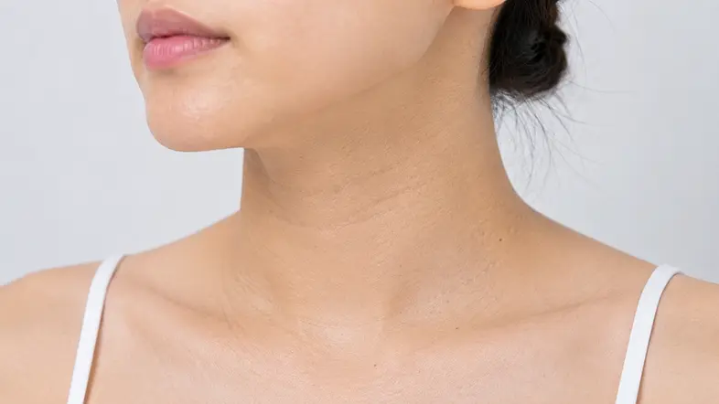 PicoSure Pro蜂巢皮秒激光頸部療程前參考圖