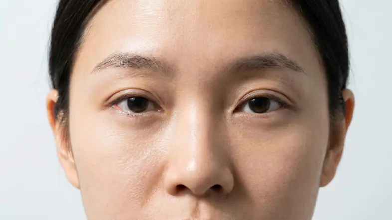 RRS西班牙眼妝針後參考圖
