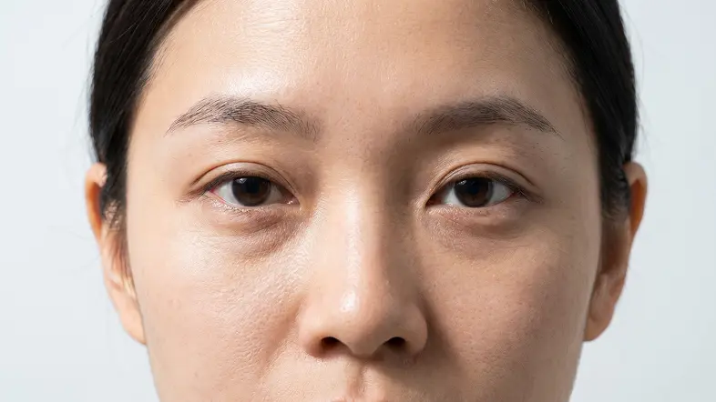 RRS西班牙眼妝針前參考圖