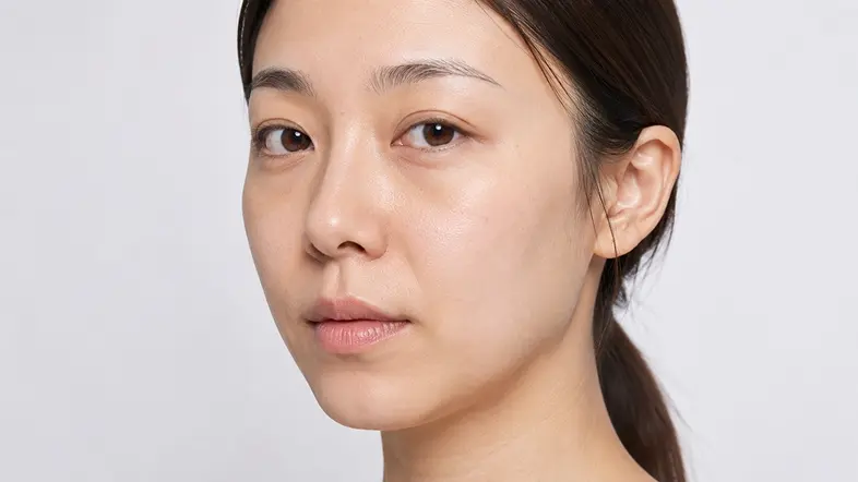 Ultherapy Prime 500高能量療程前參考圖